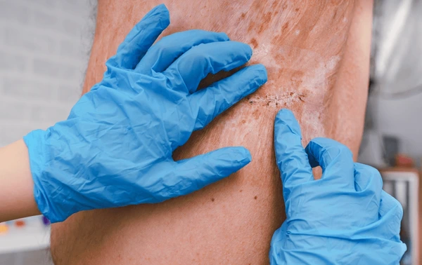 doctor-treating-wound-burn-emergency-600nw-2142935063